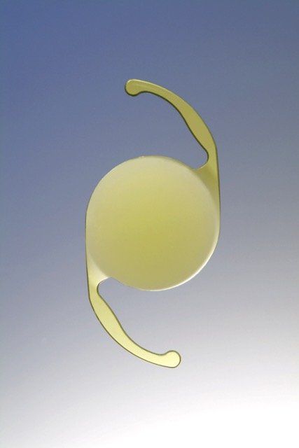 Blue Blocking Filter Lens, To Protect Macula, Alcon, SN60WF