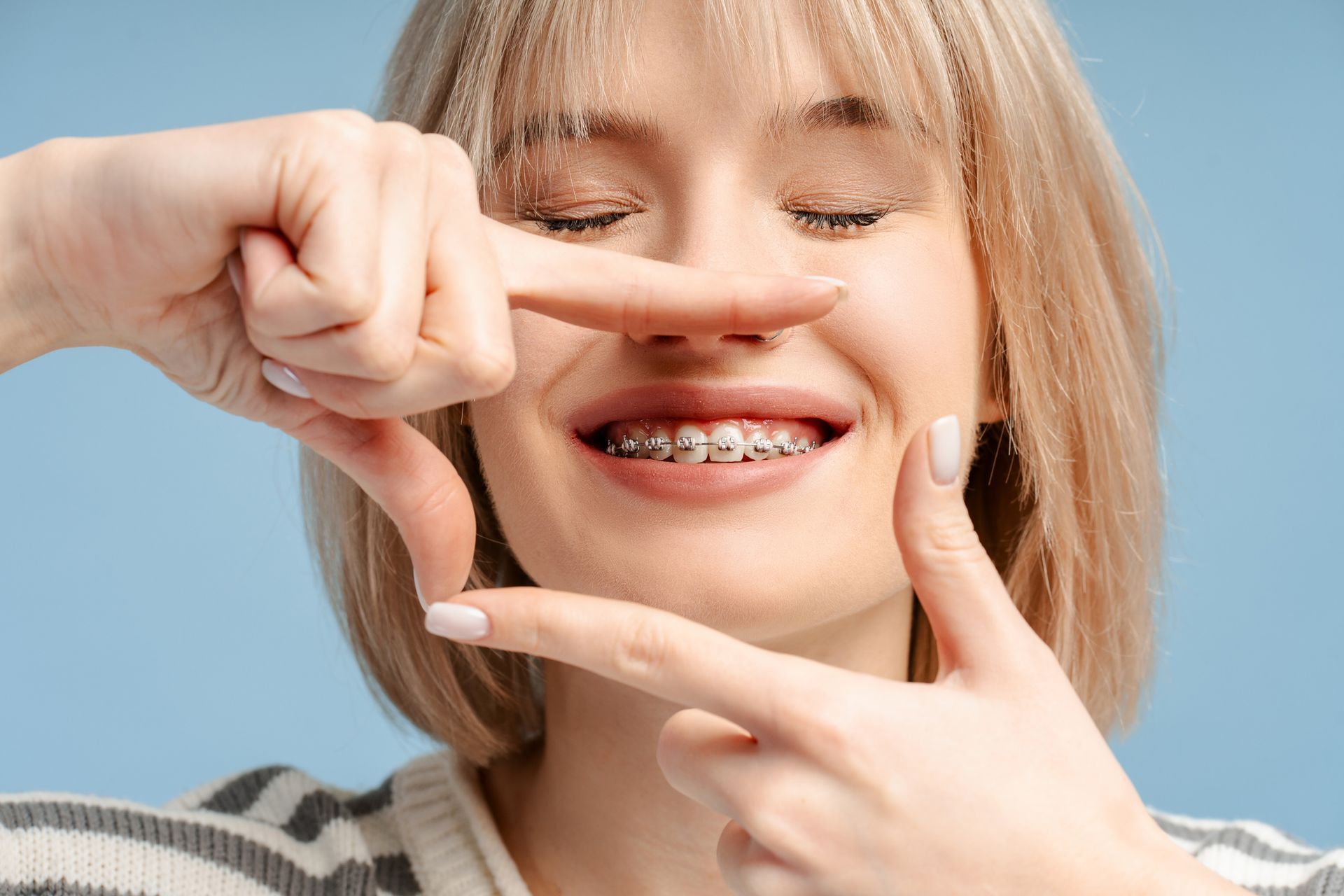 Cheerful young woman with braces framing smile with hands