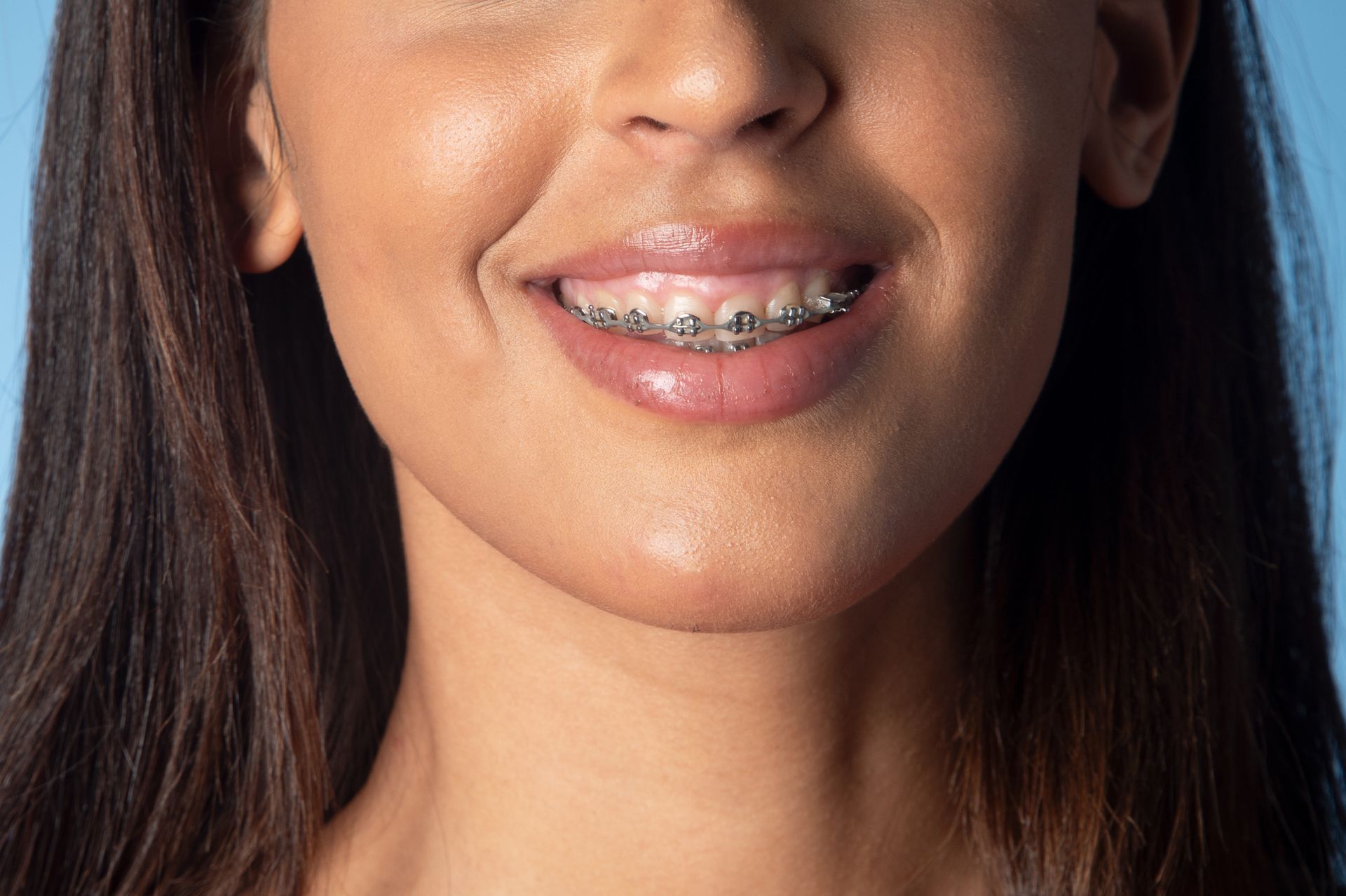 close view of a young woman smiling with braces