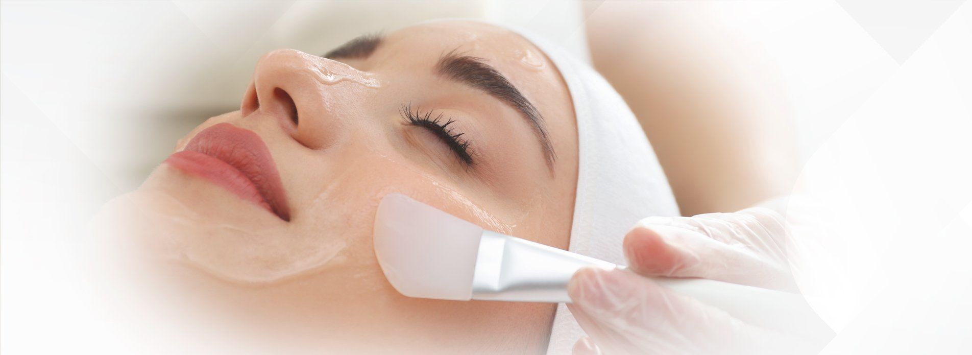 The Benefits of Chemical Peels