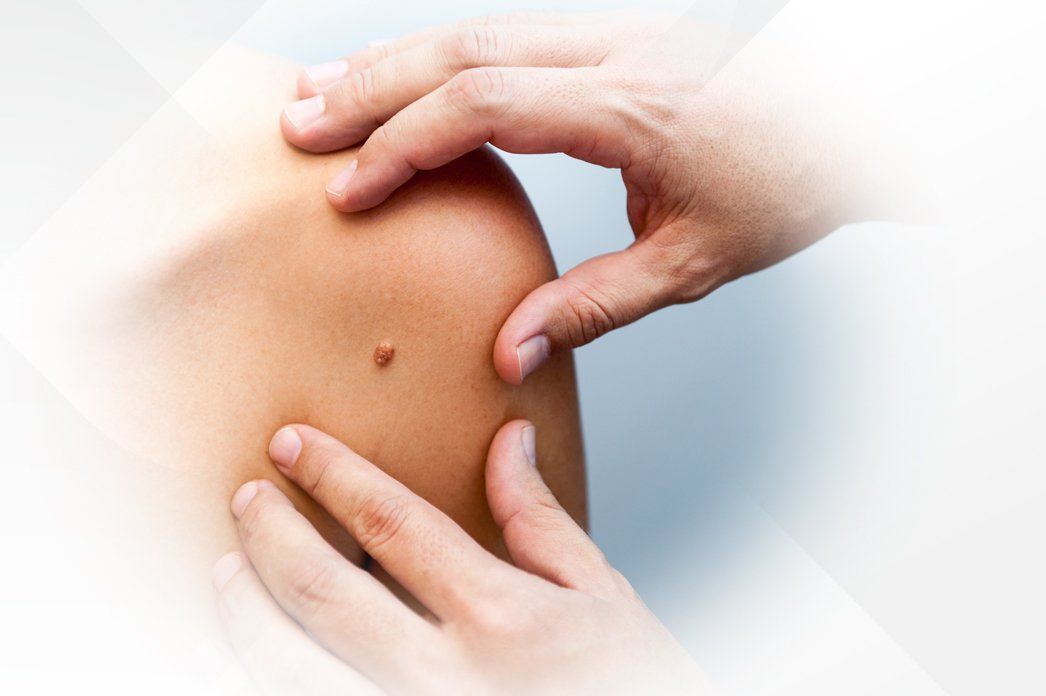 Dermatology treatment and cosmetic skin care services