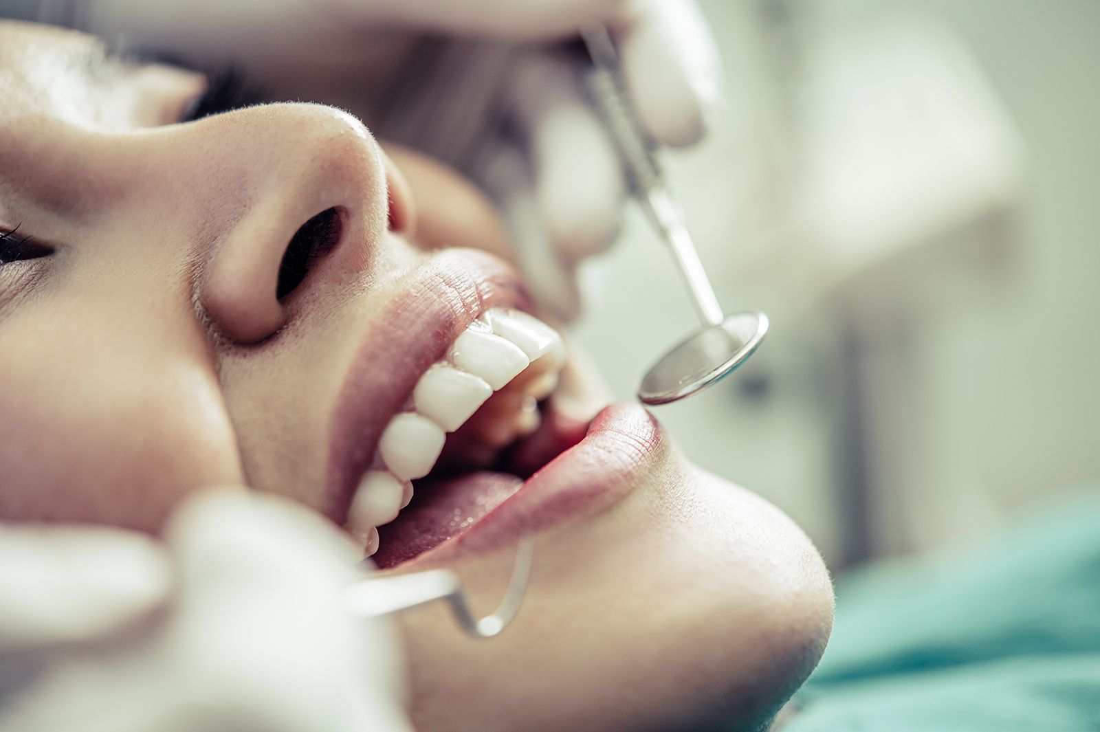 Antes y después de rehabilitación oral