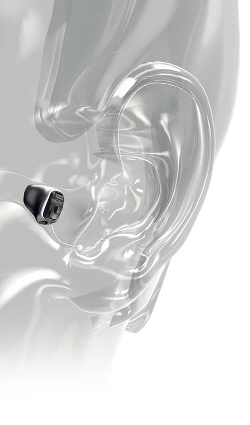 apparecchio acustico invisibile