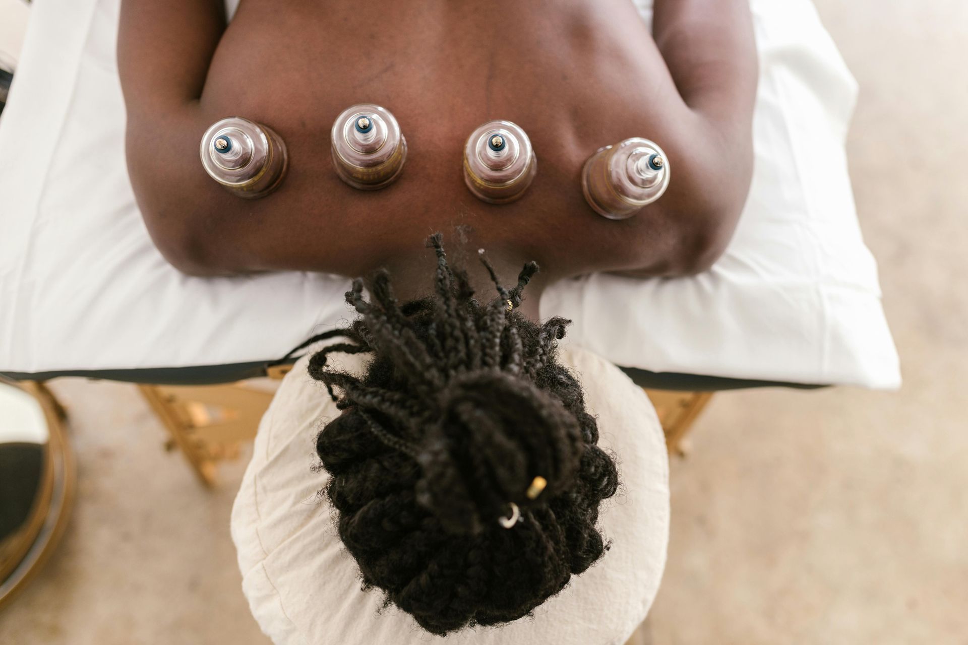 Person receiving cupping therapy on their back, four cups visible.