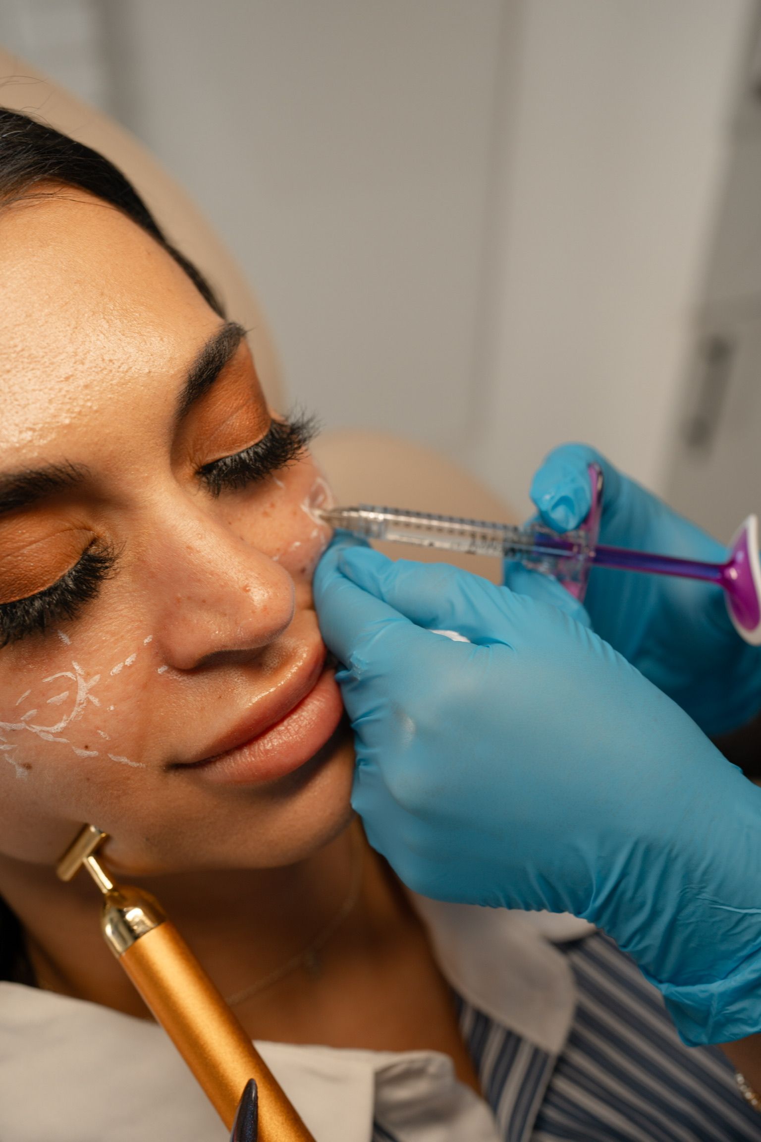 Woman receiving facial treatment; practitioner holding syringe and golden roller in clinical setting.