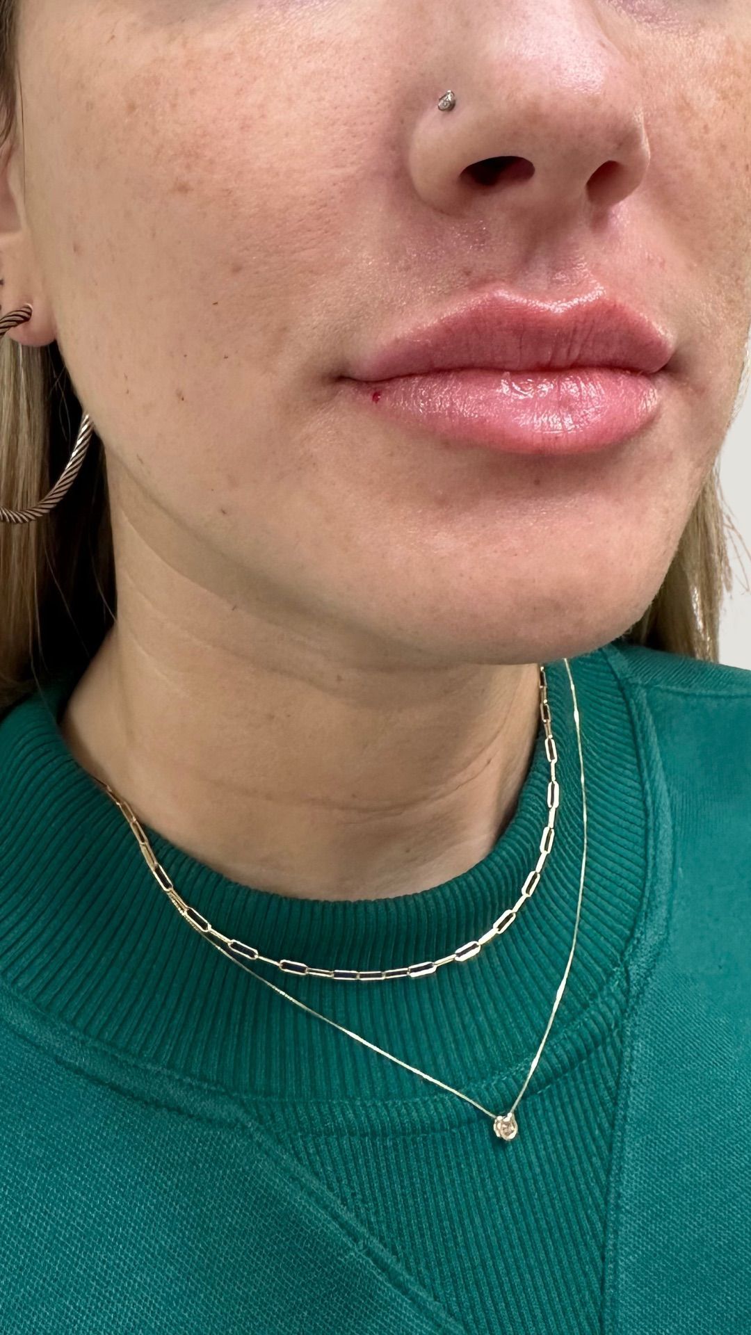 Close-up of a person's lips and neck wearing two gold necklaces and a green sweater.