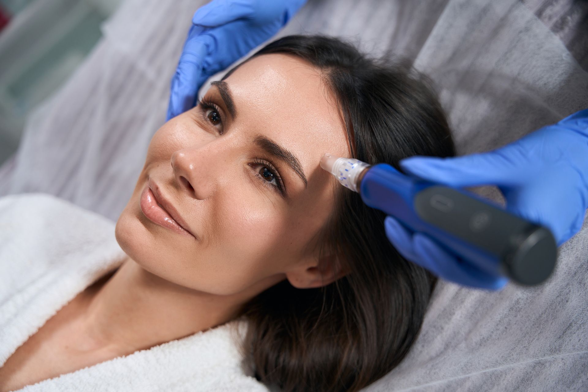 Woman receiving a microneedling treatment on her forehead by a gloved professional.