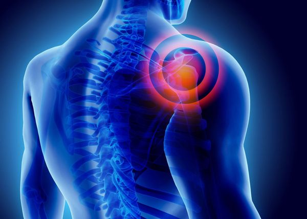 Neck Pain Woman - Prescott, AZ - Natural Back Pain Relief LLC