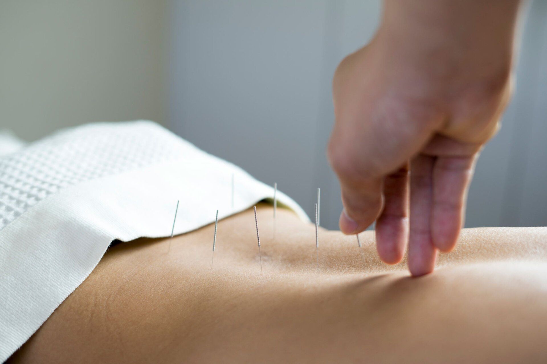 Acupuncture Treatment — Michigan — Alice Huang's Chinese Natural Therapies