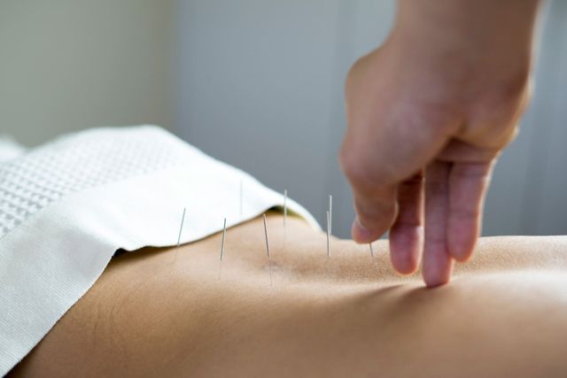 Acupuncture Pain Management in Ann Arbor, MI