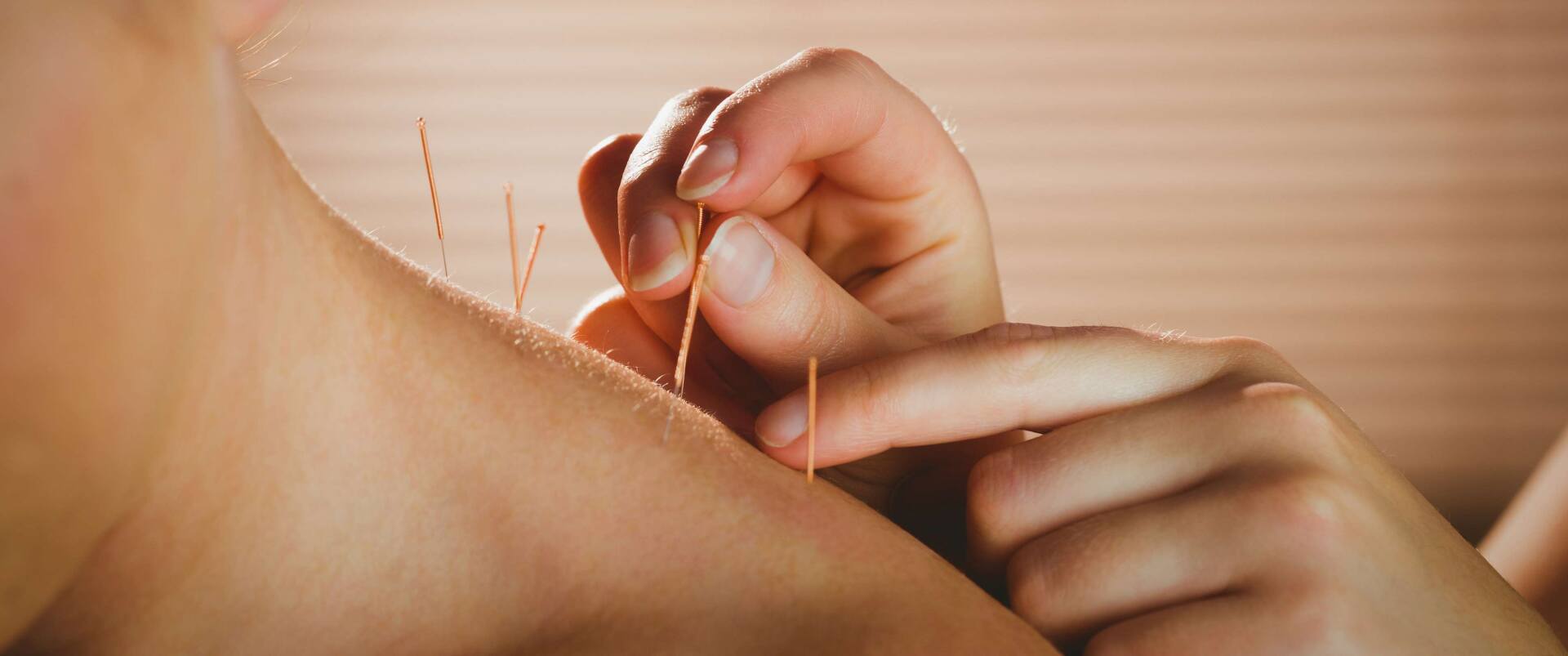 Acupuncture Treatment And A Massage — Michigan — Alice Huang's Chinese Natural Therapies