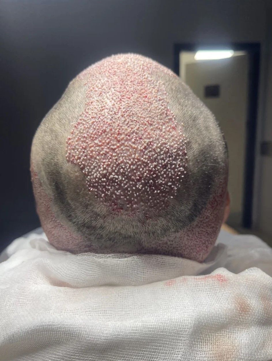 A close up of a man 's head with a towel around it.