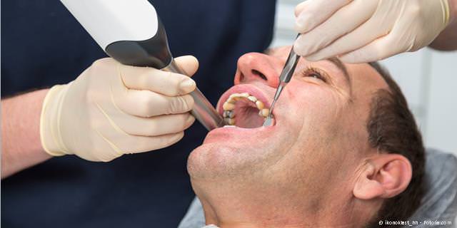 Cerec: Digitale Aufnahme der Zähne