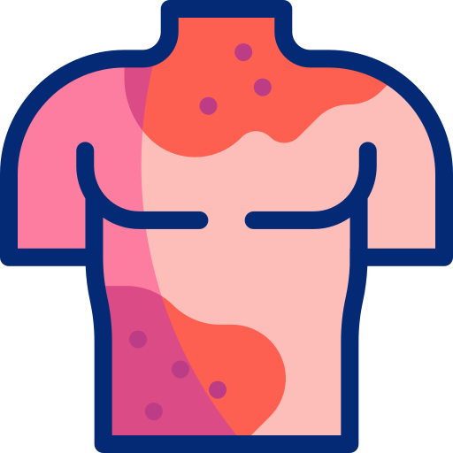 Illustration av överkroppen med rött utslag, möjligen allergisk reaktion.