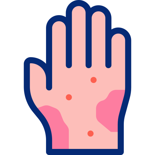 Hand med fläckar av röd hud och små röda prickar.