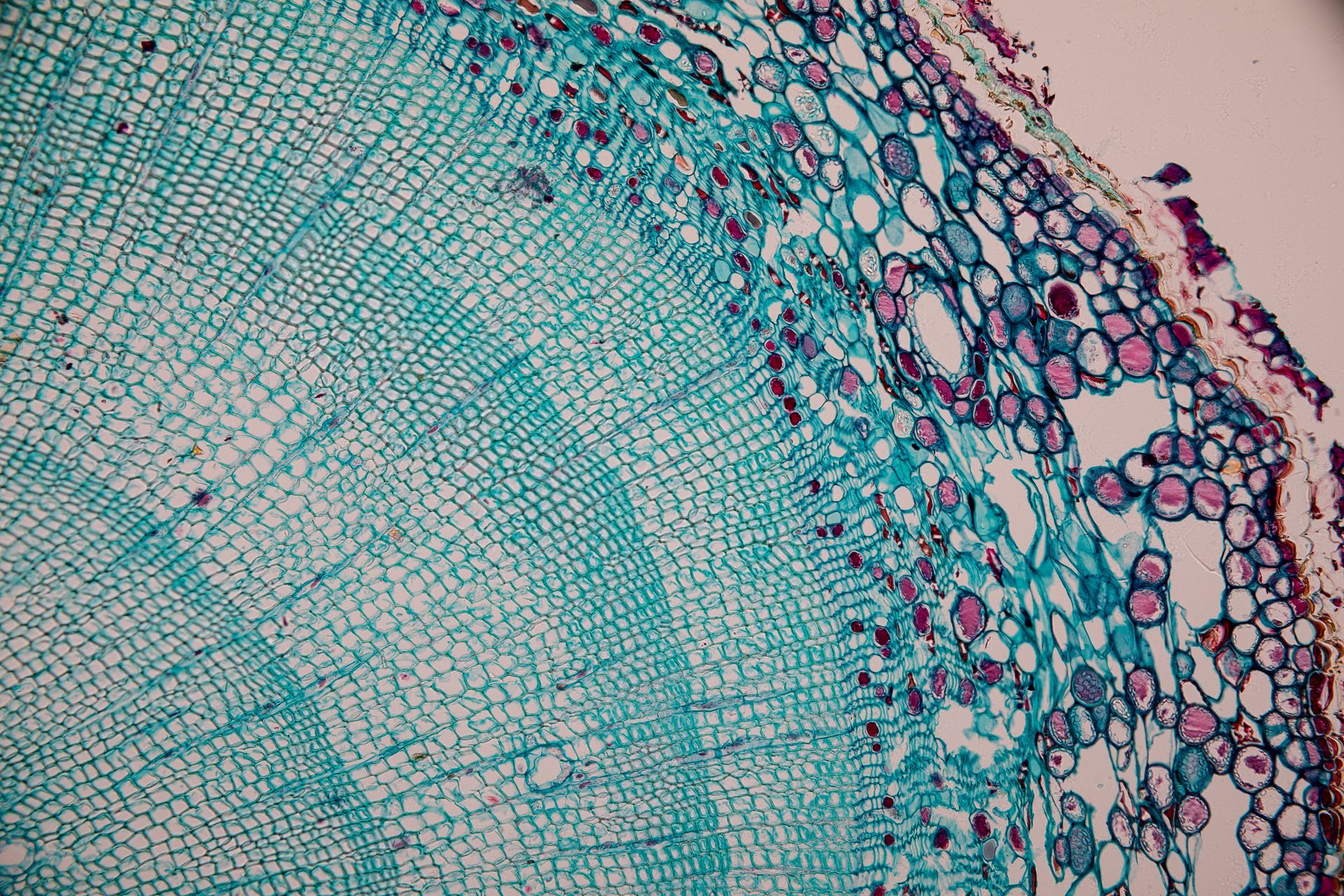 Microscopic plant tissue cross-section with turquoise cells and purple-stained outer edge