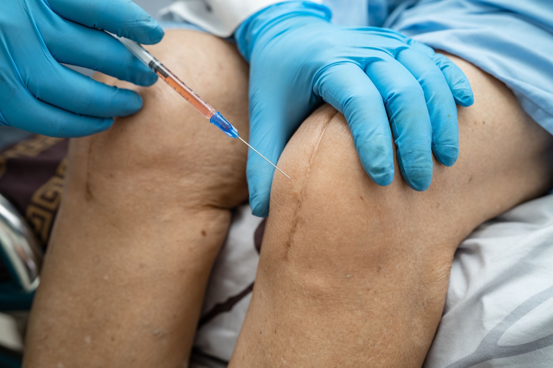 Blue-gloved hands inject a leg with a syringe near the knee.