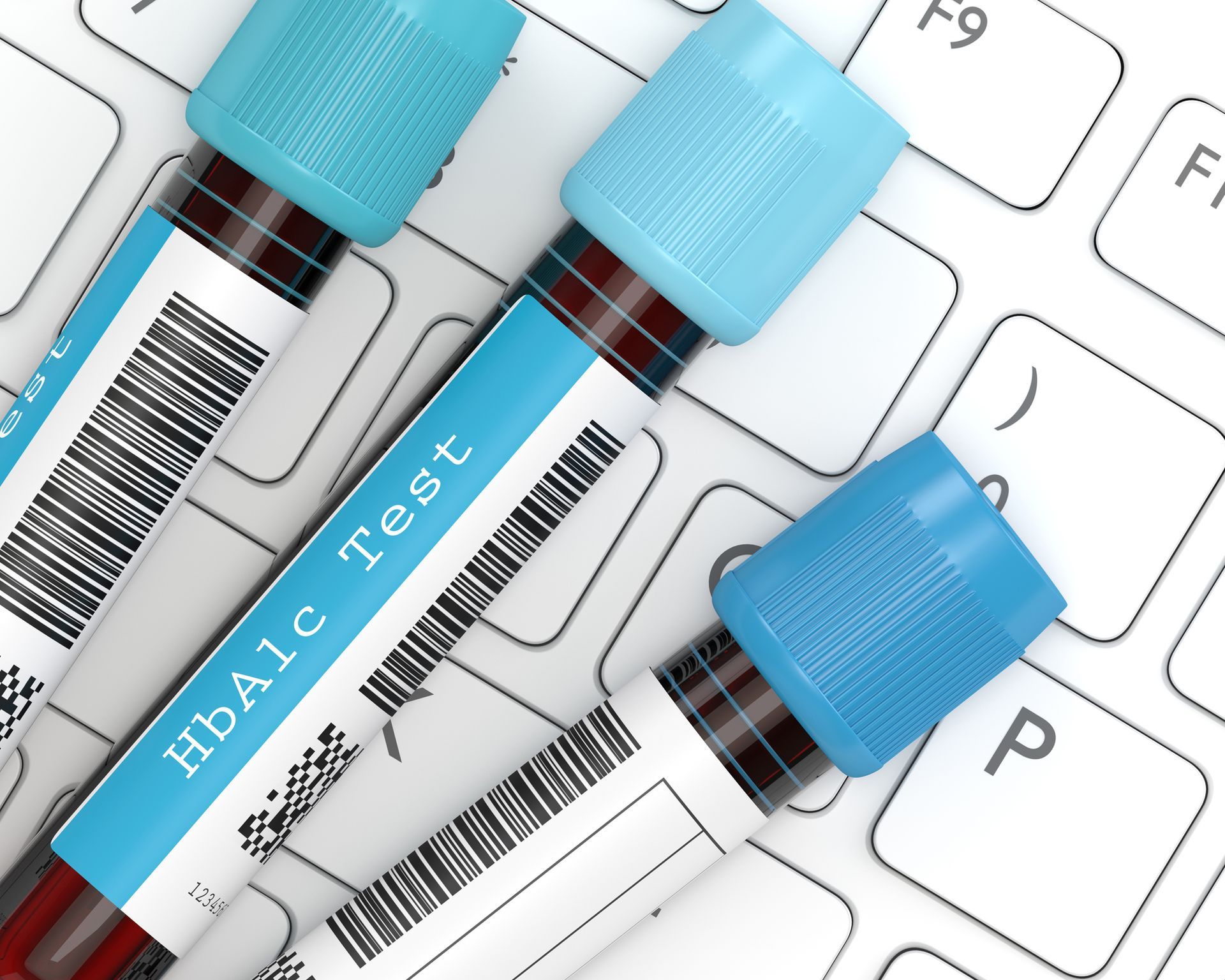 Three test tubes labeled hba1c test are sitting on a keyboard — Nicholson — Optimal Whole Health & Nutrition, PA