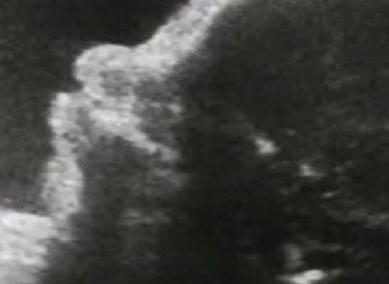 Dr. Nicolás López Camacho - Infertilidad