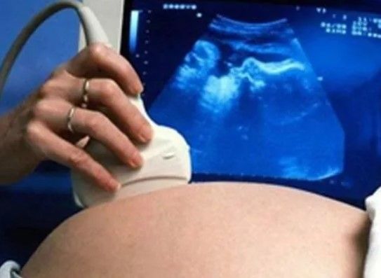 Dr. Nicolás López Camacho - Amenorrea