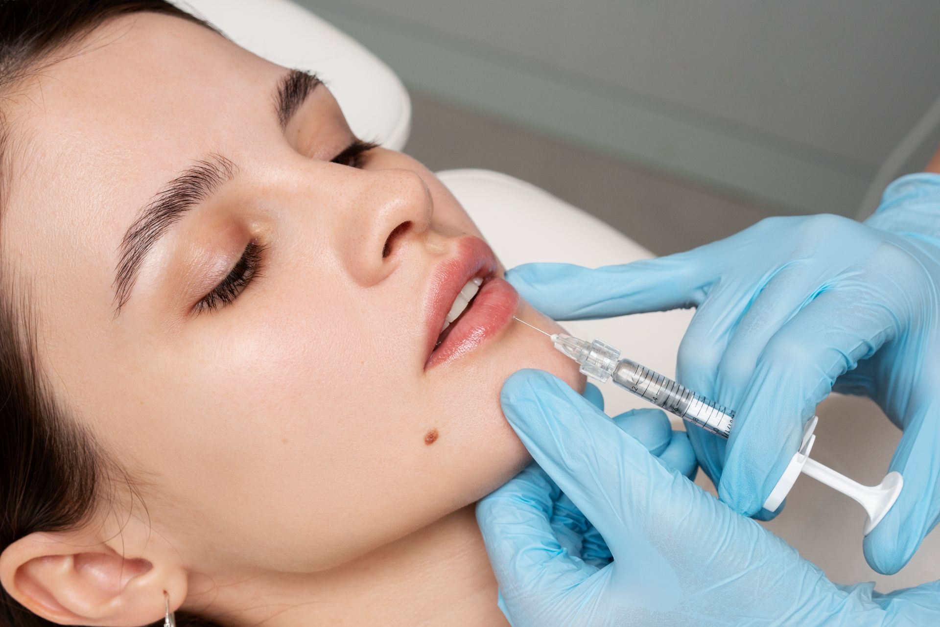 Woman receiving lip injections; blue gloves holding syringe near lips.
