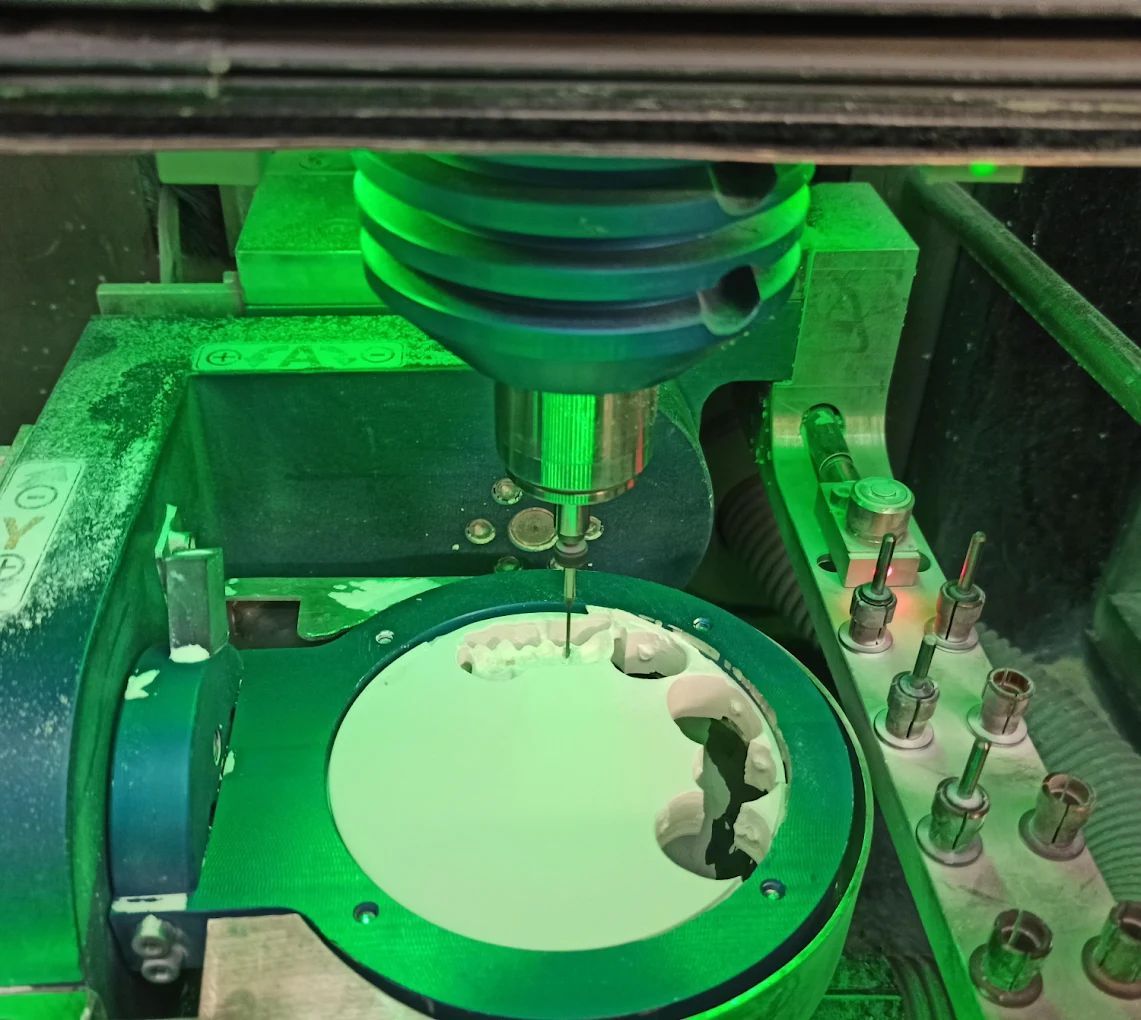 realizzazione protesi 13