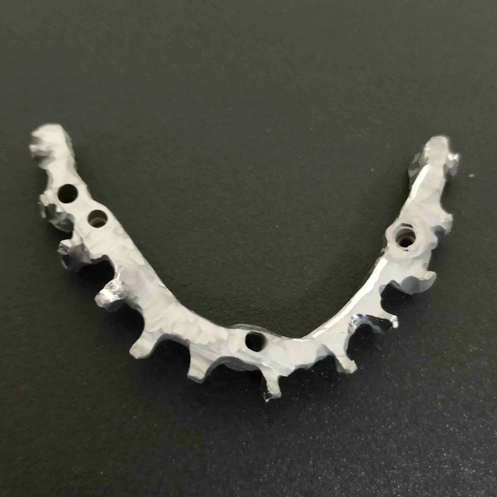 realizzazione protesi 10