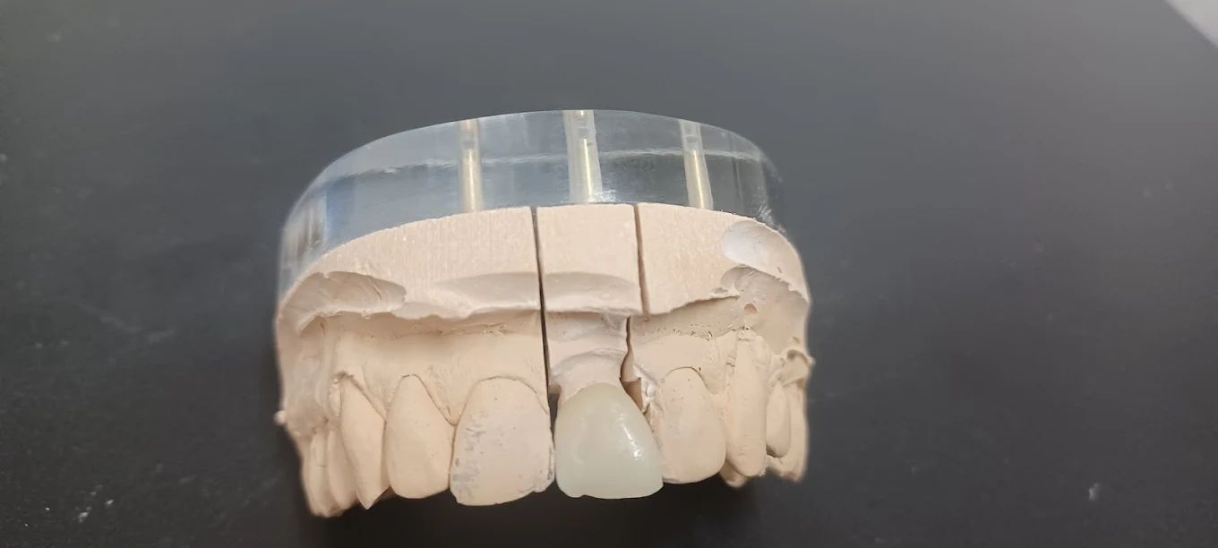 realizzazione protesi 06