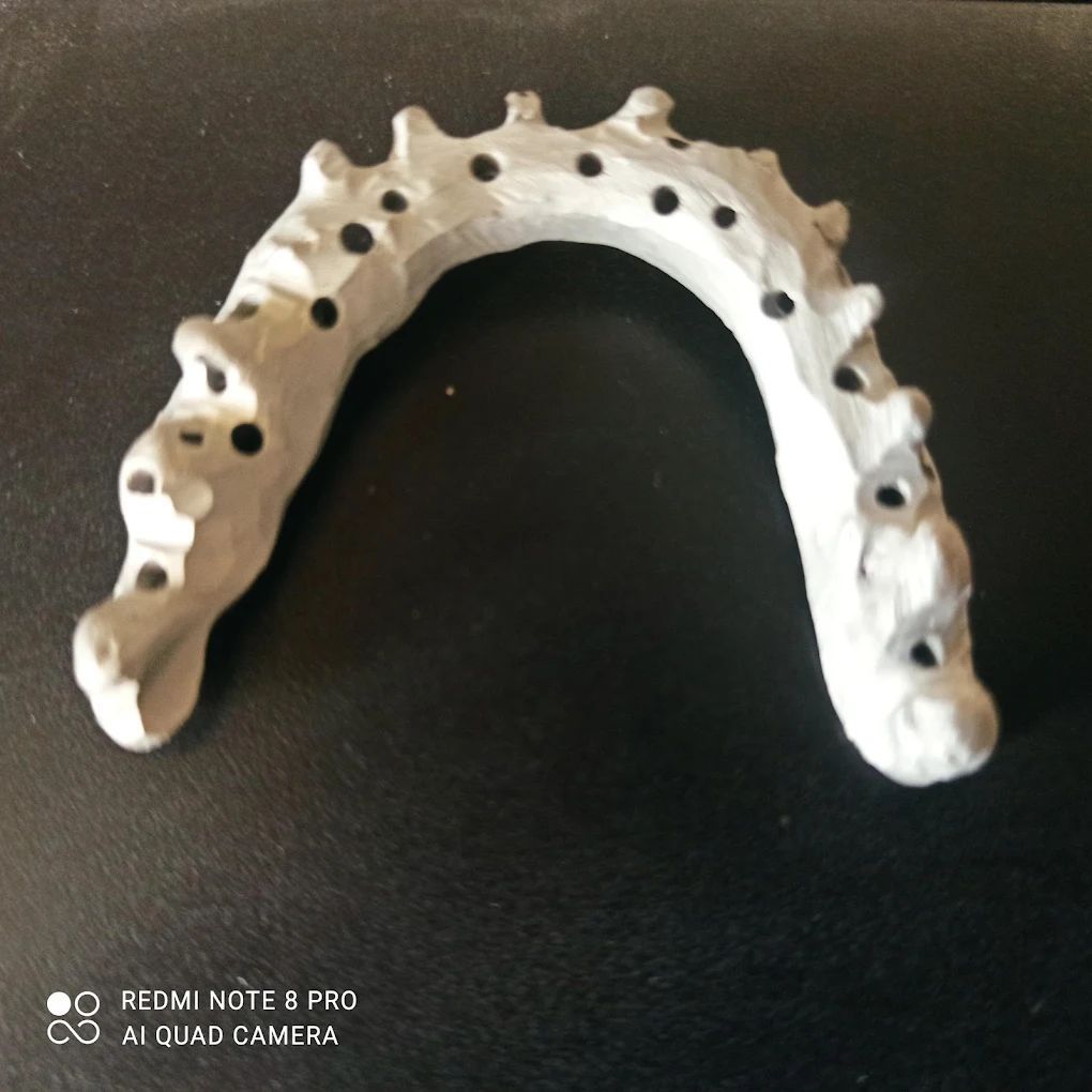 realizzazione protesi 04