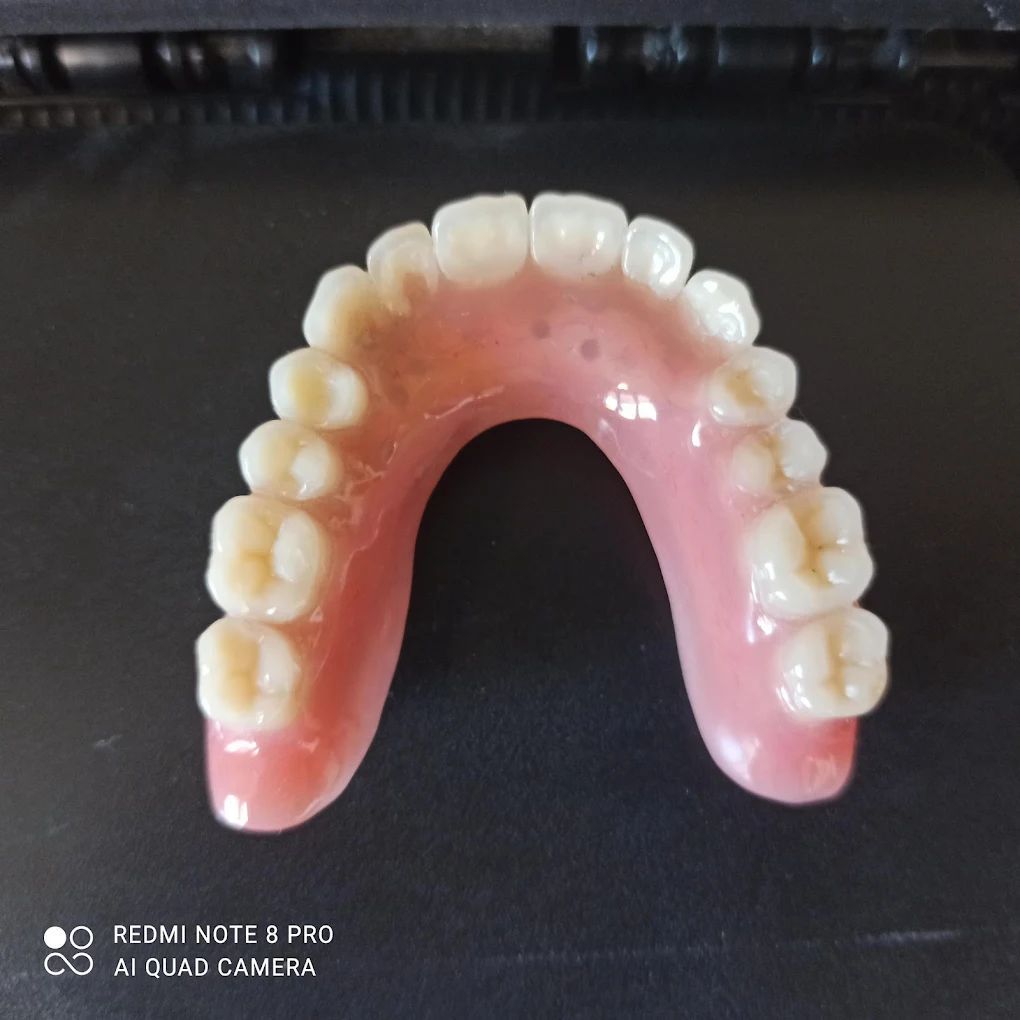 realizzazione protesi 03