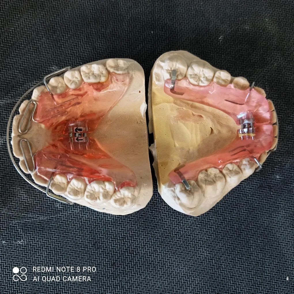 realizzazione protesi 01