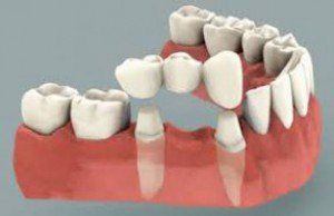 Patient Looking at Her Teeth—Restorative Dentistry in Lake Wylie, SC