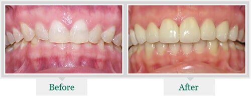 Teeth — Dentist in Lake Wylie, SC