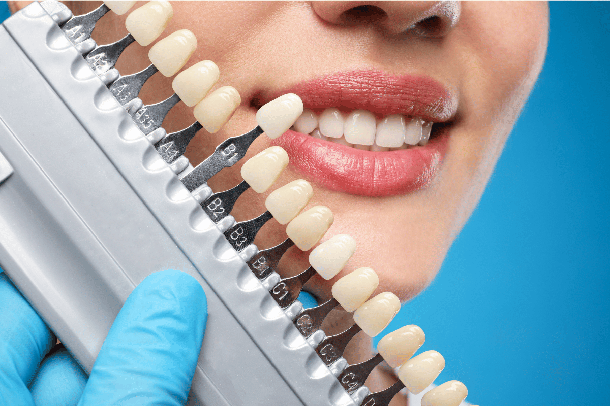 Woman comparing tooth shade to a shade guide during a dental procedure.