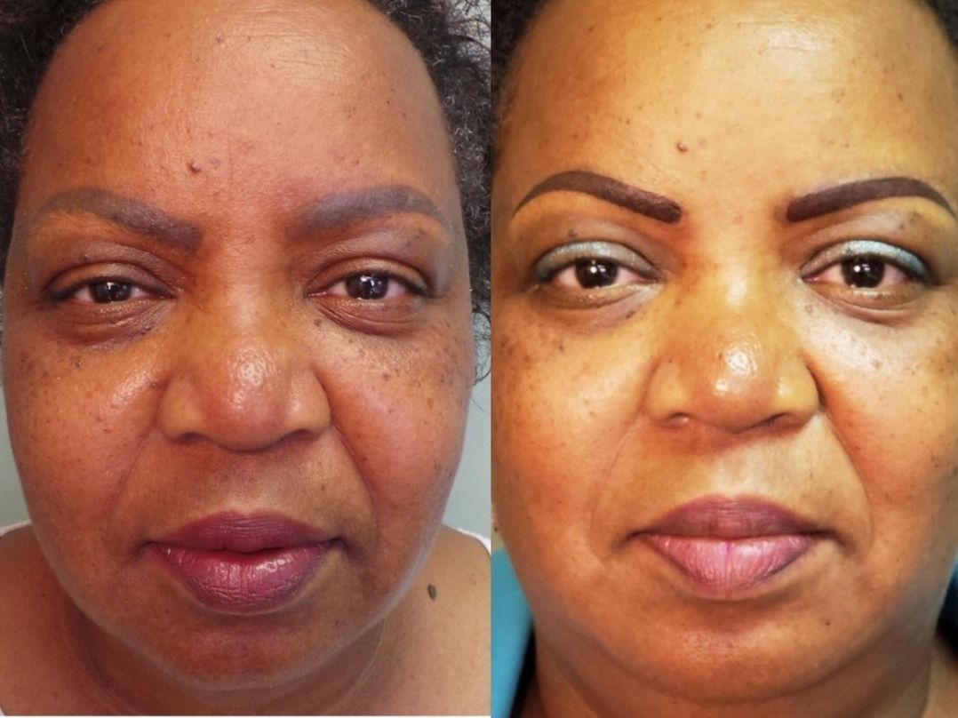 Before-and-after headshot of a woman. Left shows her with uneven skin tone,