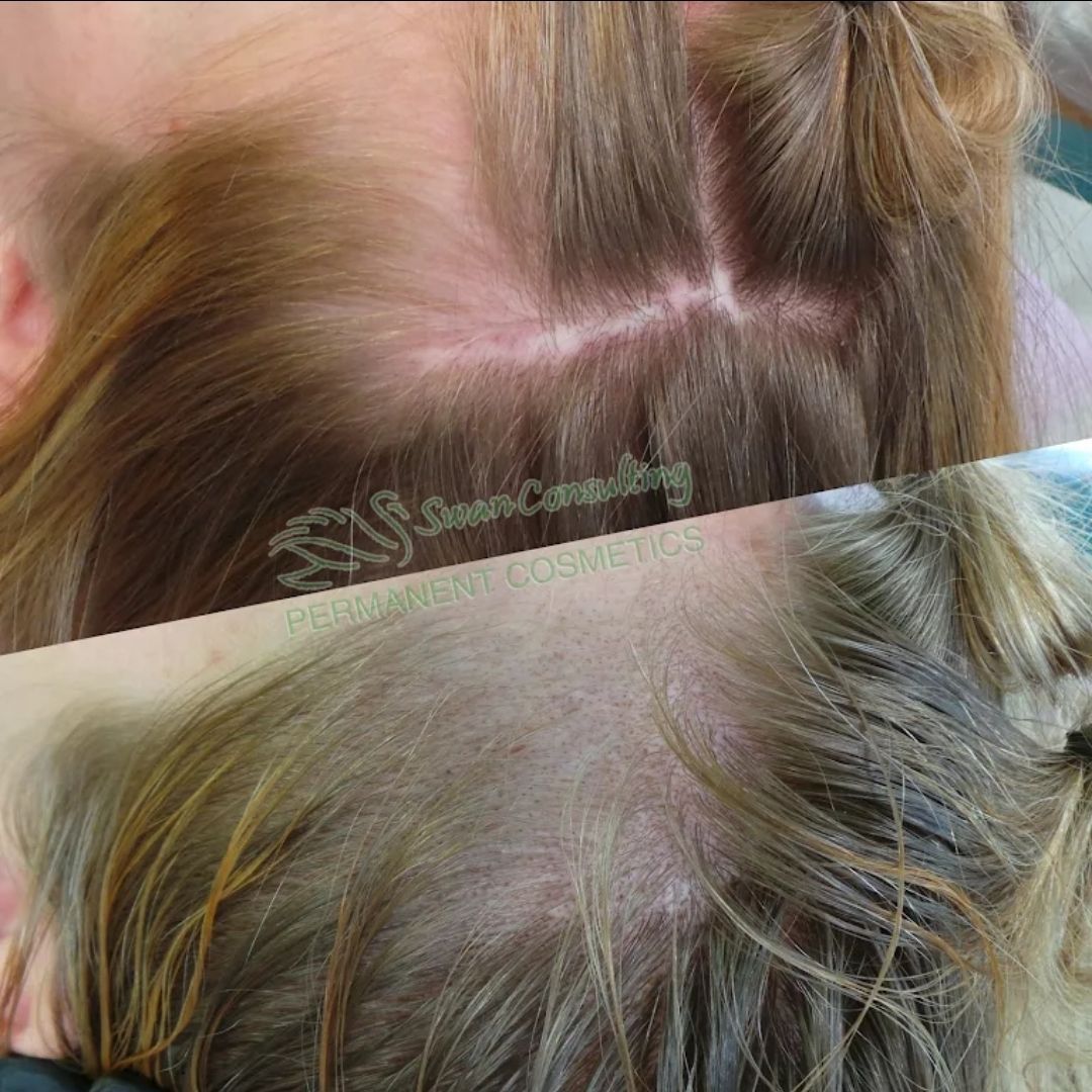Close-up of a woman's scalp before and after a cosmetic procedure,