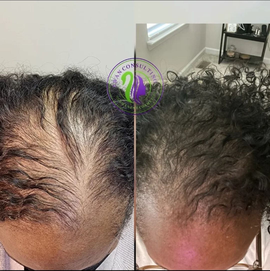 Before and after shots of a person's scalp.