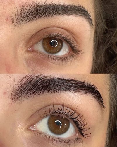 Prima e dopo l'intervento di lifting delle sopracciglia e delle ciglia, che mette in risalto sopracciglia e ciglia più scure e folte.