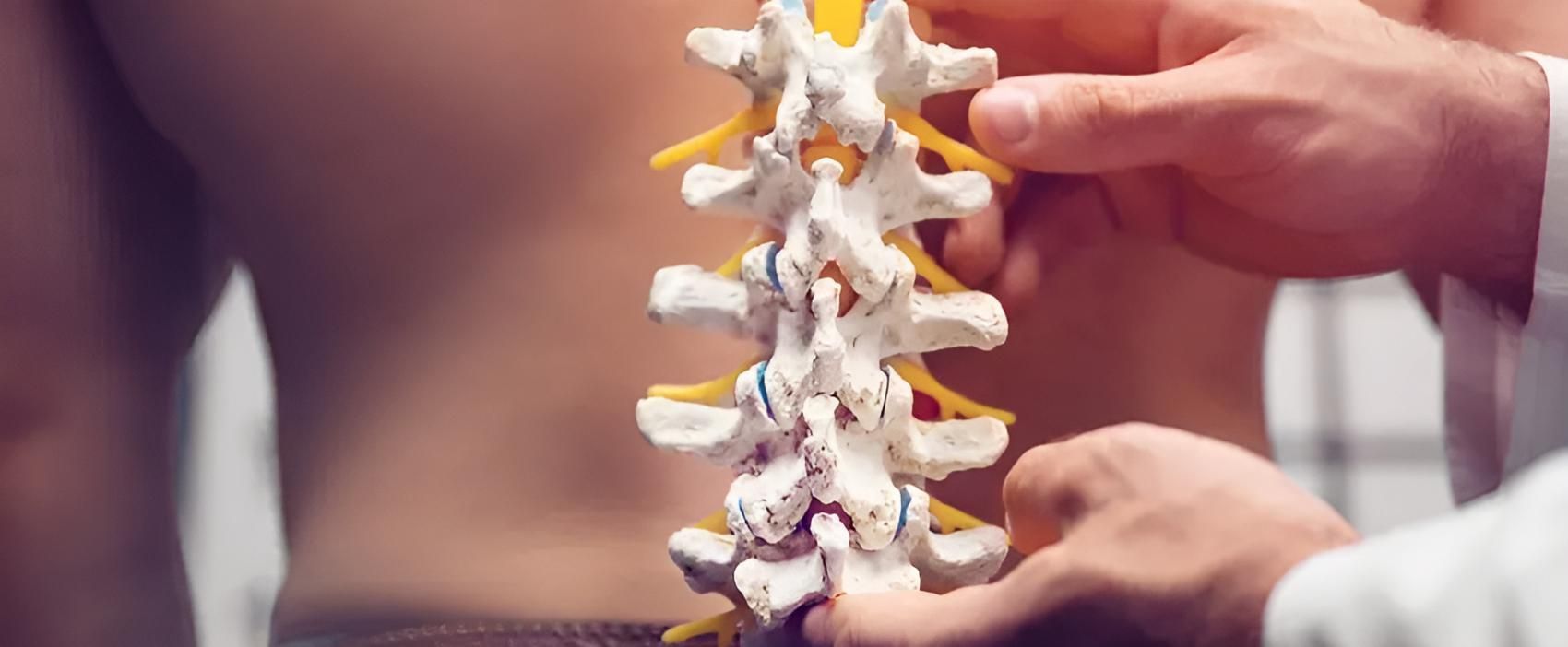 A Doctor is Holding a Model of a Person's Spine — Back Care Gold Coast in Nerang, QLD