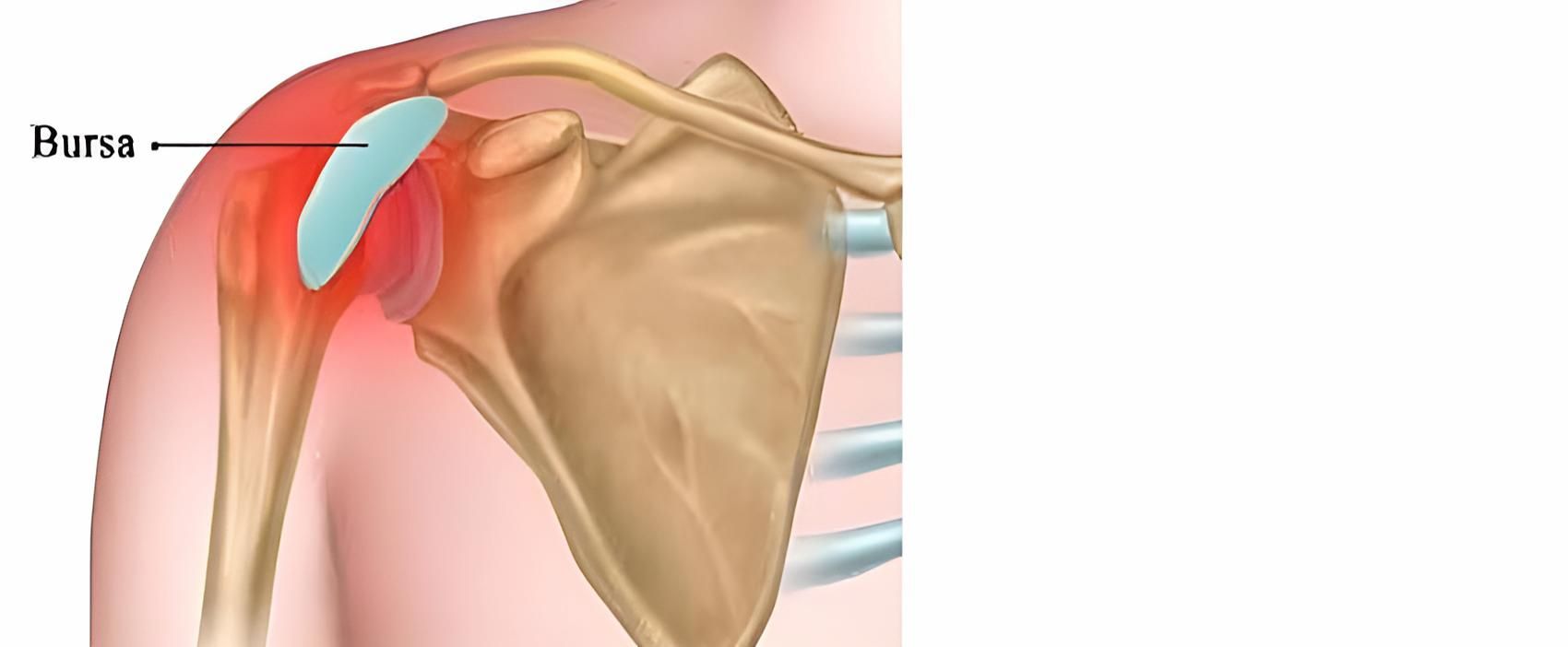A Diagram of a Person's Shoulder Showing the Bursa — Back Care Gold Coast in Nerang, QLD