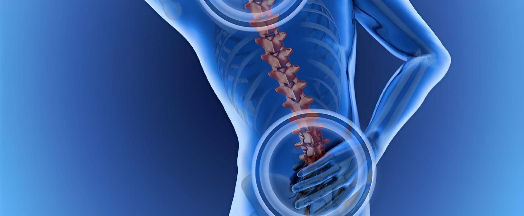 A X-ray of a Person 's Back Showing the Spine — Back Care Gold Coast in Nerang, QLD