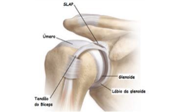 dor-ombro-dr-guilherme-noffs-ortopedista-ombro-sao-paulo