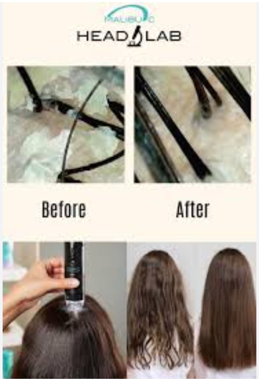 close-up scalp shots