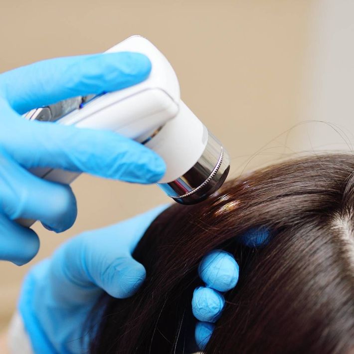Hair Prosthetics