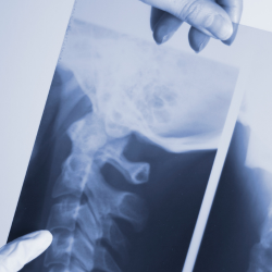 a chiropractor is holding an x-ray of a neck