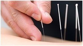 perfezionamento agopuntura
