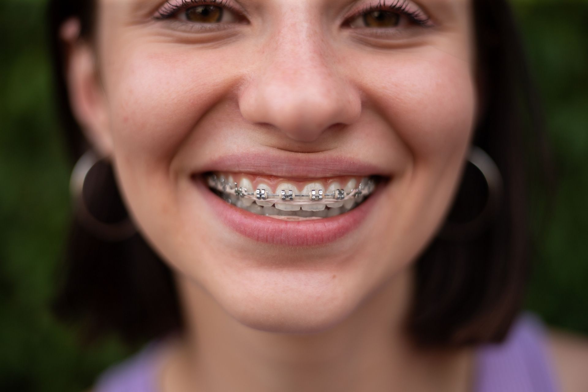 A close up of a woman 's face with braces on her teeth.