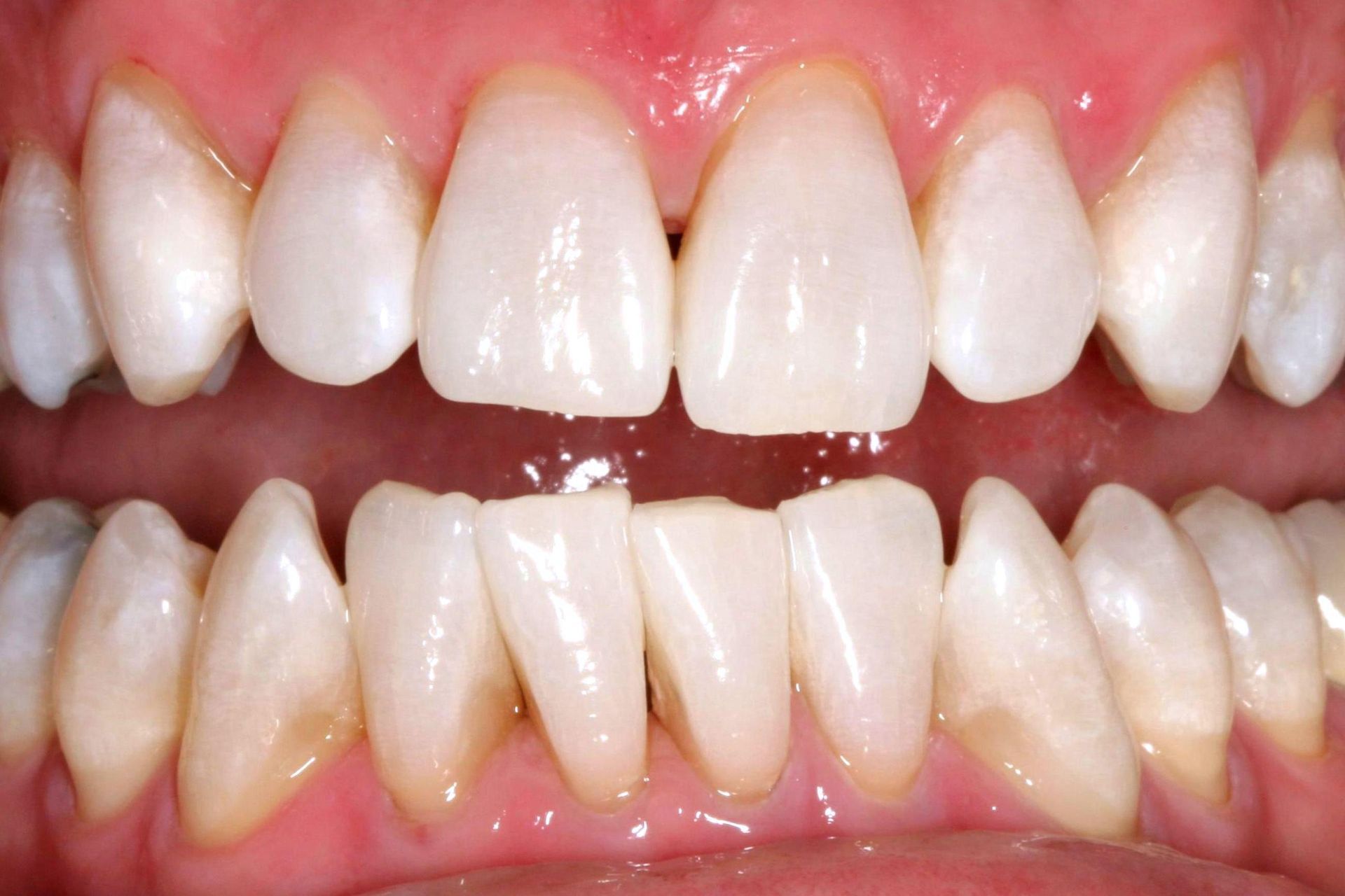 A close up of a woman 's face with a smile on her face.