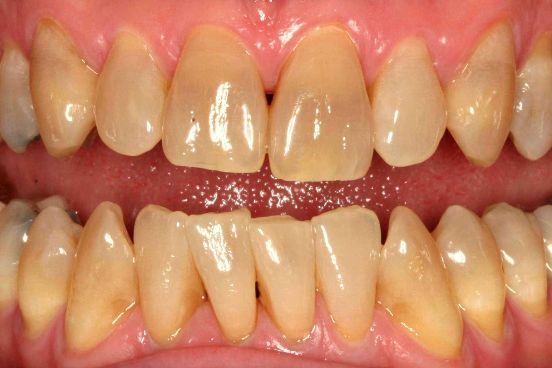 A young girl wearing glasses is smiling for the camera