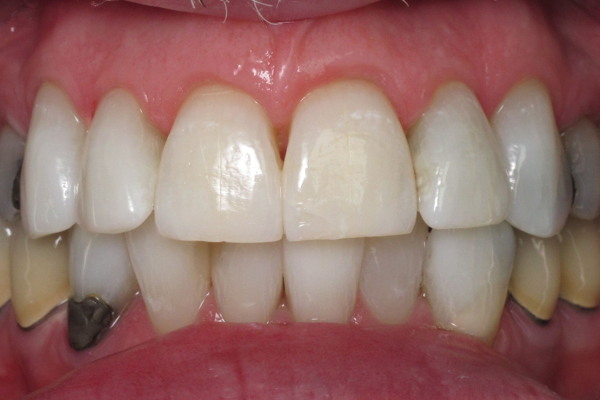 A close up of a woman 's face with a smile on her face.